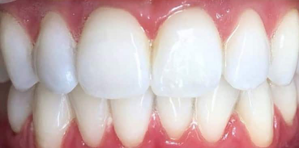 After — James K.